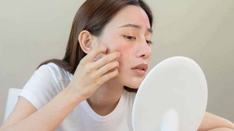 Nhiều người sở hữu làn da nhạy cảm vẫn e ngại với kem chống nắng do trải nghiệm tiêu cực từ các sản phẩm không phù hợp. | Nguồn: Shutterstock