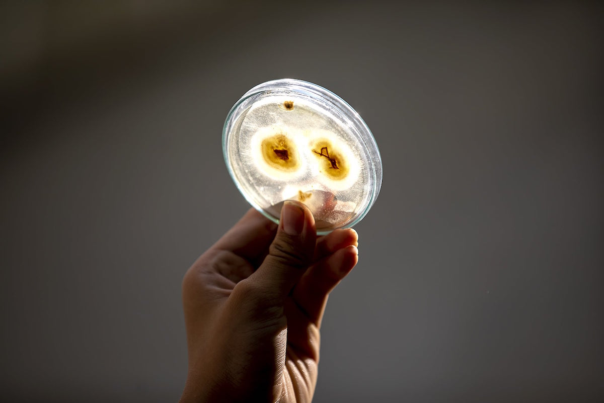 One project I have been able to invest a lot of time into is my Nato Bean Research Im growing my batch of Japanese fermented beans to study their effects on improving heart health — something Ive always been passionate about | Source Maika Elan for Vietcetera